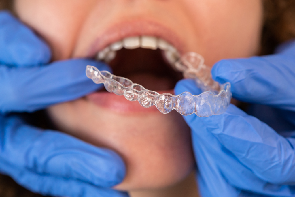 Featured image for “Does Invisalign Hurt? The Truth About Pain and Comfort”